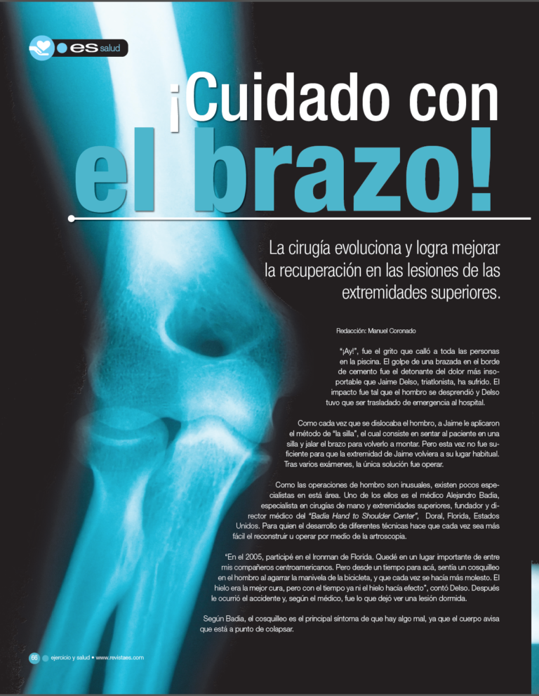 cuidado con el brazo